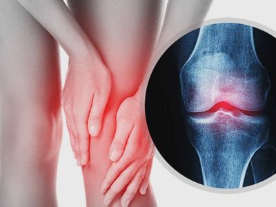 Вы постоянно испытываете боли в коленном, тазобедренном или плечевом суставе?